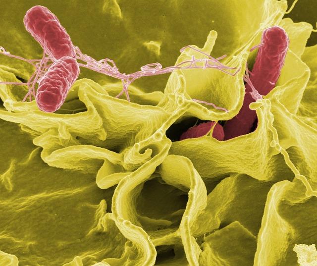 Escherichia coli: Domáca liečba a prevencia infekcií